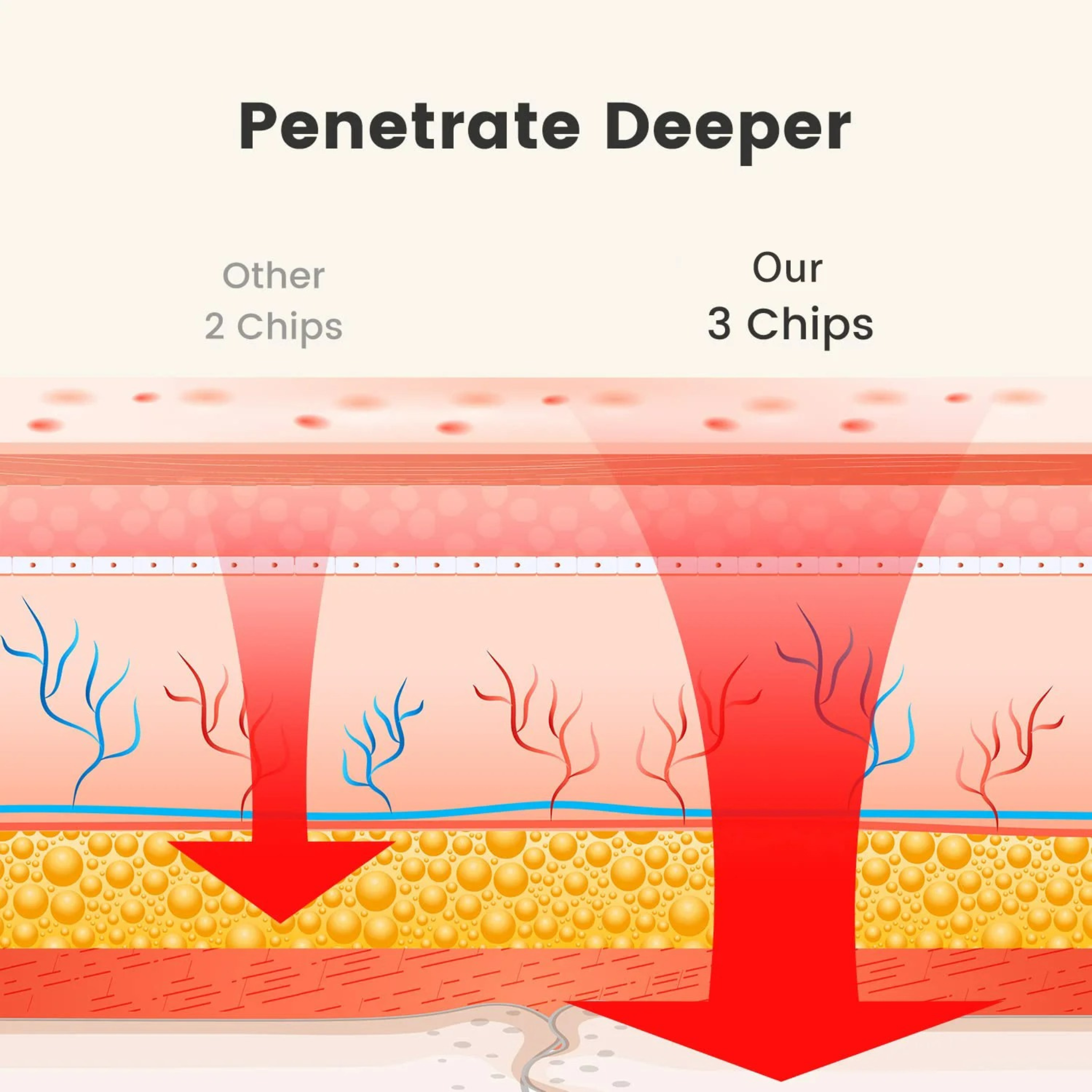 Cinto de Terapia de Luz Vermelha LumaFlex para Redução de Gordura em Casa