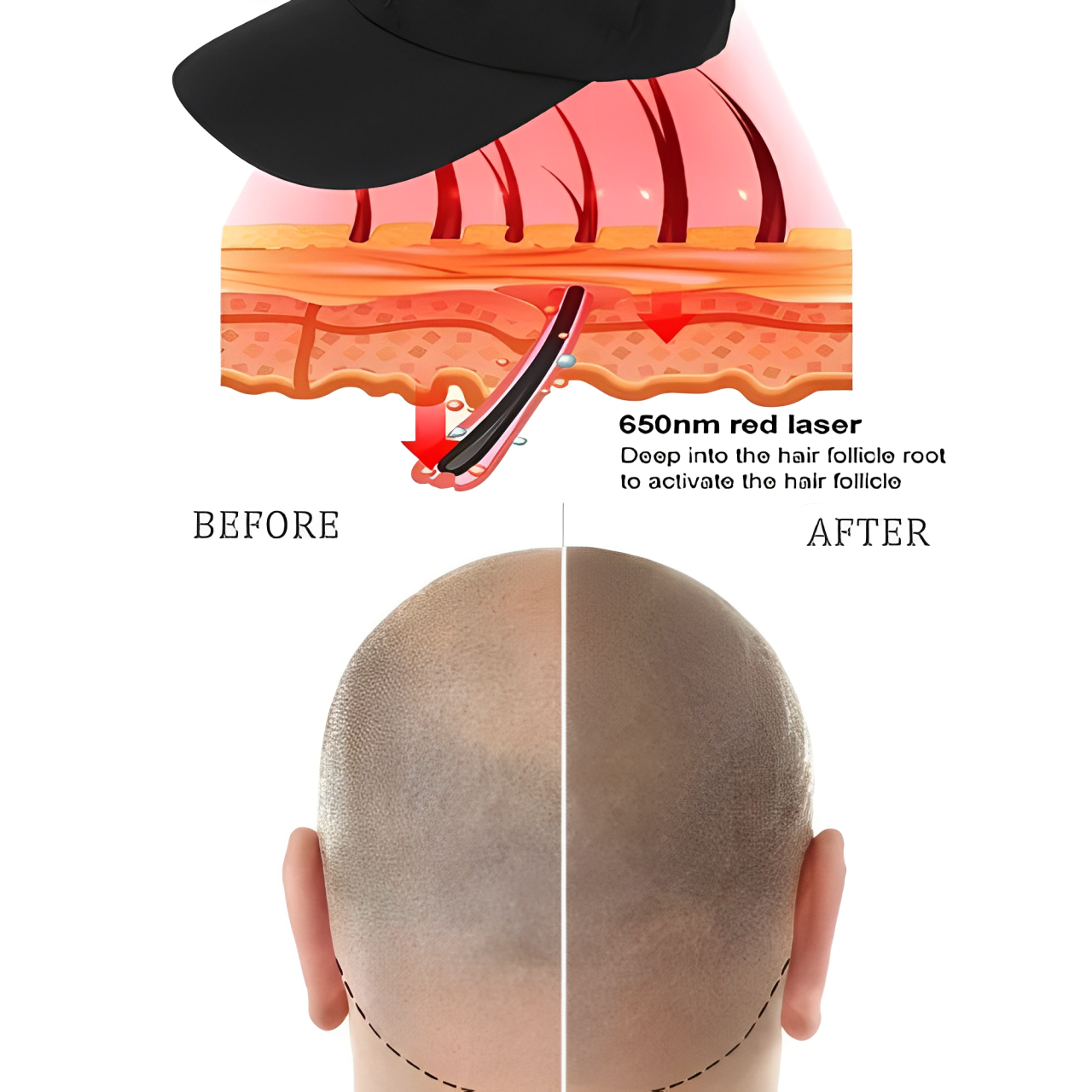 NovaCap Red Light Laser Cap For Hair Growth Therapy