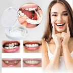 NovaSmile Instant Snap-On Veneers for Upper and Lower Teeth