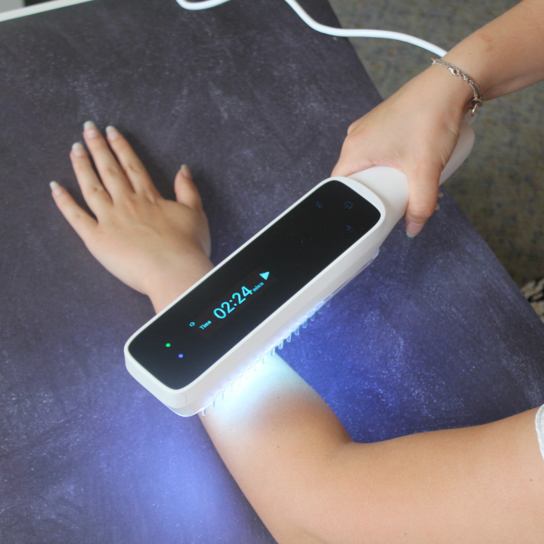 LumaPulse Handheld UVB Narrowband Phototherapy Lamp