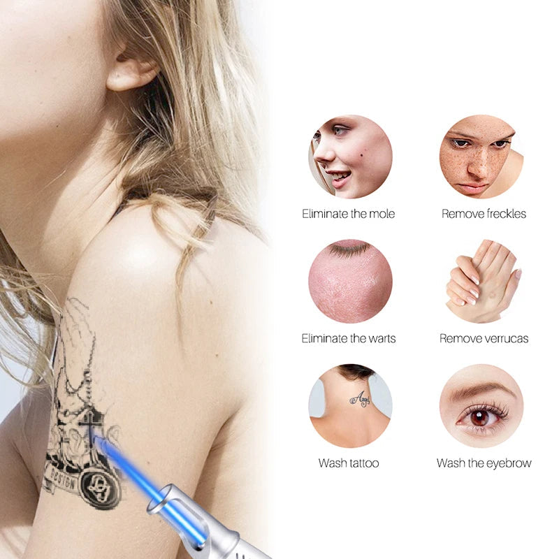 NovaDerm Laser Pen For Tattoo, Moles And Freckles Removal