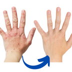 Virelle Arthritis Rotlichttherapie Nahinfrarot-Handschuhe