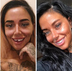 NovaSmile Instant Snap-On Veneers for Upper and Lower Teeth