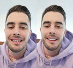 NovaSmile Instant Snap-On Veneers for Upper and Lower Teeth