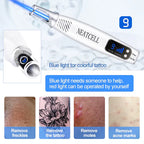 NovaDerm Laser Pen For Tattoo, Moles And Freckles Removal