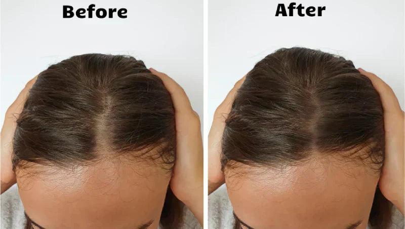 NovaWave Hair Light Therapy for Thicker, Fuller Hair