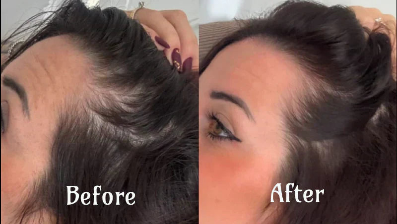 NovaWave Hair Light Therapy for Thicker, Fuller Hair