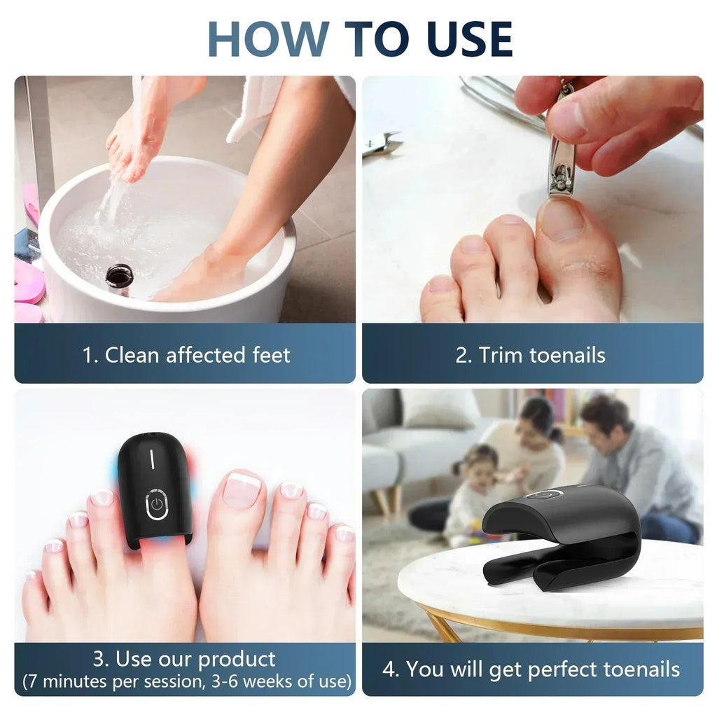 NovaNail Laser Therapy For Toenails With USB Charge