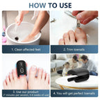 NovaNail Laser Therapy For Toenails With USB Charge
