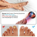 NovaNail Laser Therapy For Toenails With USB Charge
