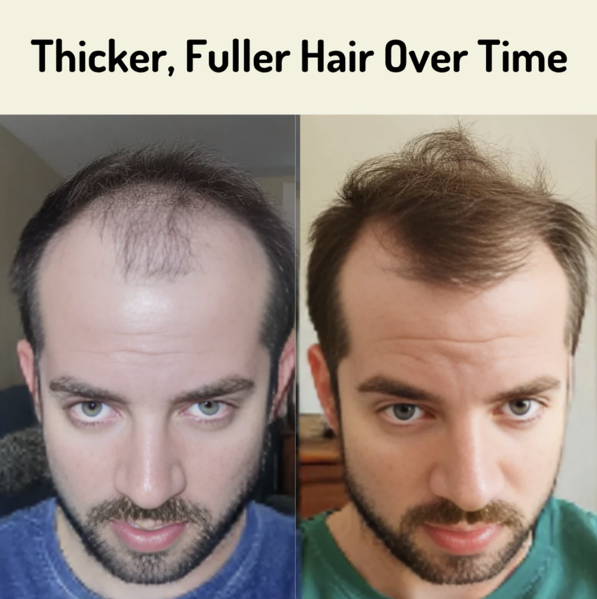 Unexo: Rotes Licht Wachstumskappe - Für Haarwachstum