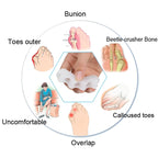 Hammer Toe Orthopedic Toe Splint Brace for Alignment