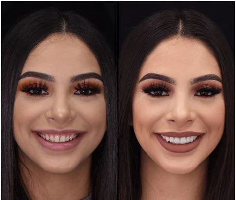 NovaSmile Instant Snap-On Veneers for Upper and Lower Teeth