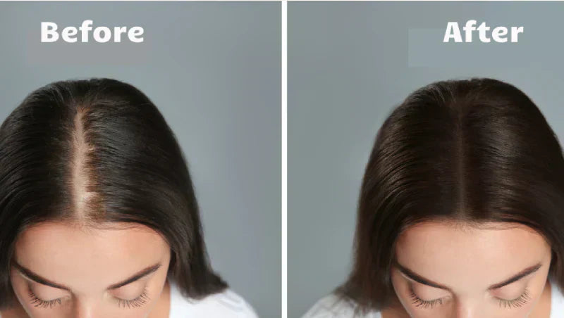 NovaWave Hair Light Therapy for Thicker, Fuller Hair