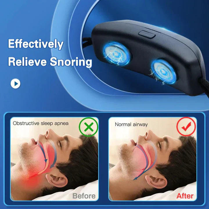PulseStop Smart Anti-Snore Device USB Portable Sleep Aid